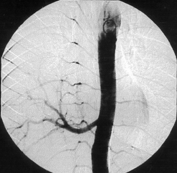 Pruebas diagnósticas por imagen