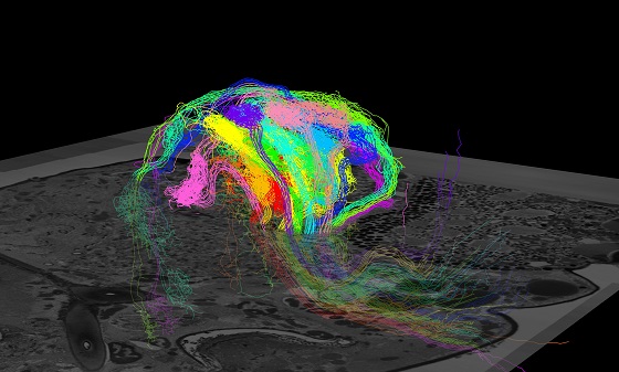 Flatiron Institute/CCB, Janelia Farm/HHMI, Micro Insect Lab/Moscow State University.